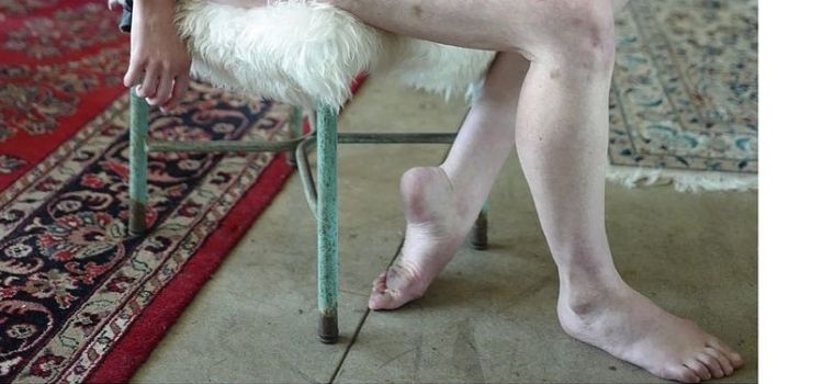 Pics Ana Tipton Feet And Legs